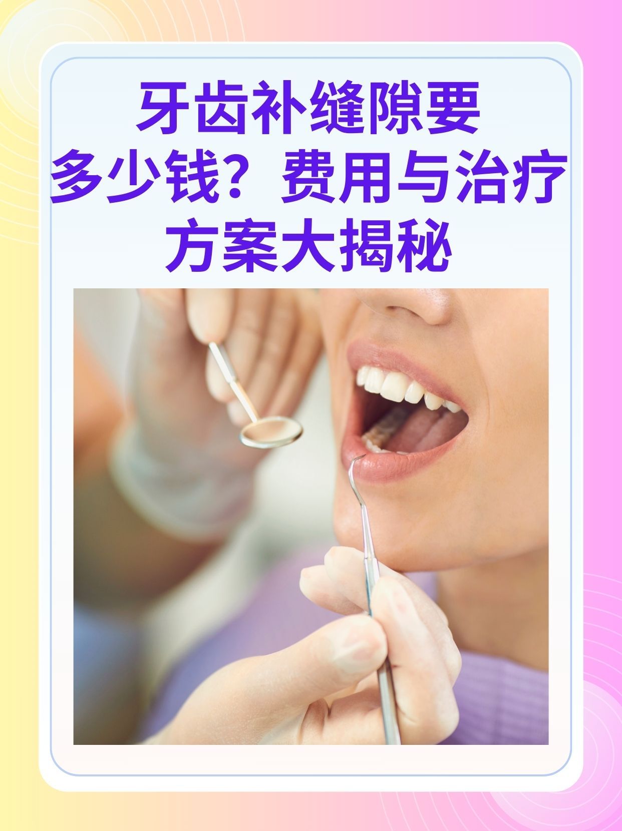 三明补牙医保可以报销吗(补牙医保可以报销吗 哪些可以报销呢)